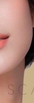 서초흉터치료, 다양한 흉터 유형 사진 21