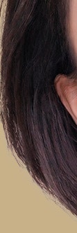 서초흉터치료, 다양한 흉터 유형 사진 18