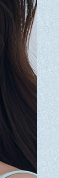 필러는 부담스러운데 탄력은 놓치고 싶지 않다면? 신반포역울트라콜 사진 23
