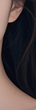 필러는 부담스러운데 탄력은 놓치고 싶지 않다면? 신반포역울트라콜 사진 22