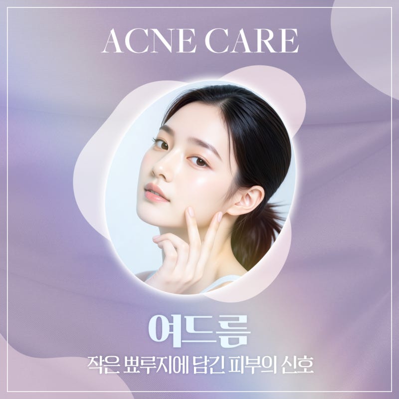신반포역여드름, 올바른 관리 습관 사진 2