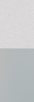 신반포역울트라콜, 자연스럽게 볼륨과 탄력을 되찾는 방법 사진 12