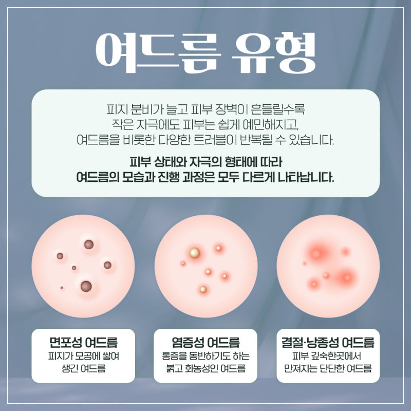 반복되는 반포여드름, 원인부터 알아야 하는 이유 사진 4