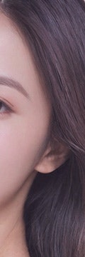 반포동울트라콜, 탄력 관리로 선택되는 이유 사진 17
