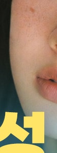 서초 기미 치료, 제대로 효과 보기 위해서는? 사진 18