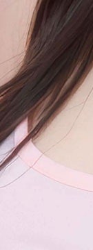 방배 문신제거 시작 전 흔히 놓치는 3가지 사진 23
