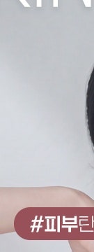 용산 울트라콜, 필러와 다른 점부터 알아야 하는 이유 사진 16