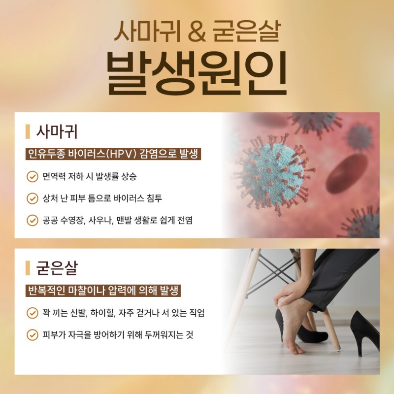 신반포역 사마귀 정확한 구별이 먼저인 이유