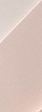 반포 고우리 스킨부스터, 필러 대신 선택하는 이유 사진 14