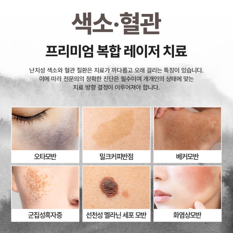신반포역 색소 프로그램 알아본다면, 색소치료 후 관리까지
