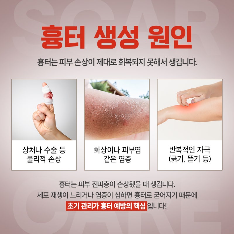 고속터미널 피부과 흉터치료 방법, 패인 흉터와 색 자국은 다릅니다