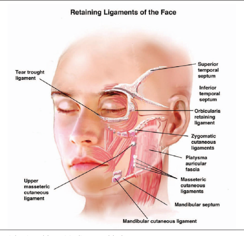 리프팅 시술에서 중요한 ‘리프팅 포인트’- 얼굴 유지 인대 (Retaining Ligament)