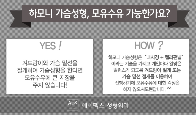 talk talk ! 가슴성형이야기