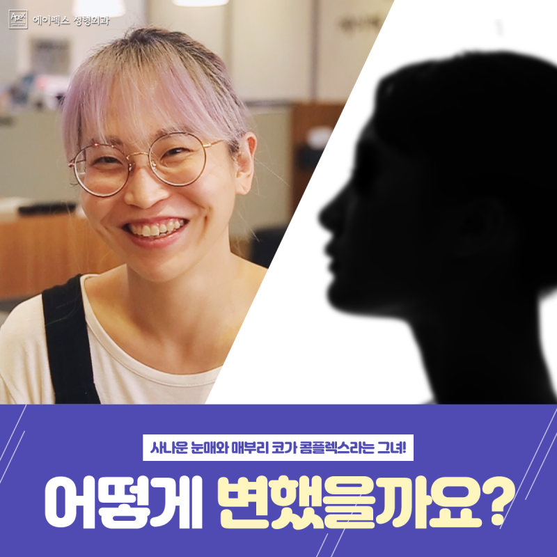 ♡에이펙스성형외과♡ "리얼스토리 수술 후 애프터 공개 예고편"