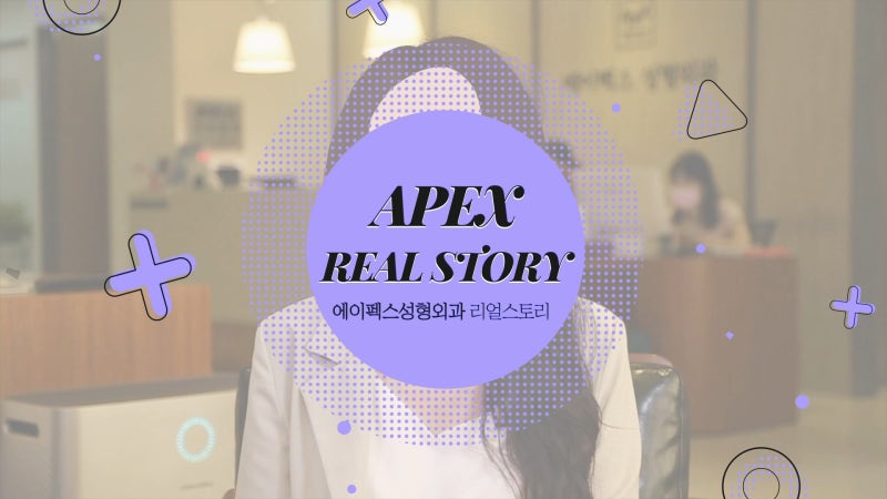 ♡에이펙스성형외과 리얼모델♡ 성형전 리얼 인터뷰