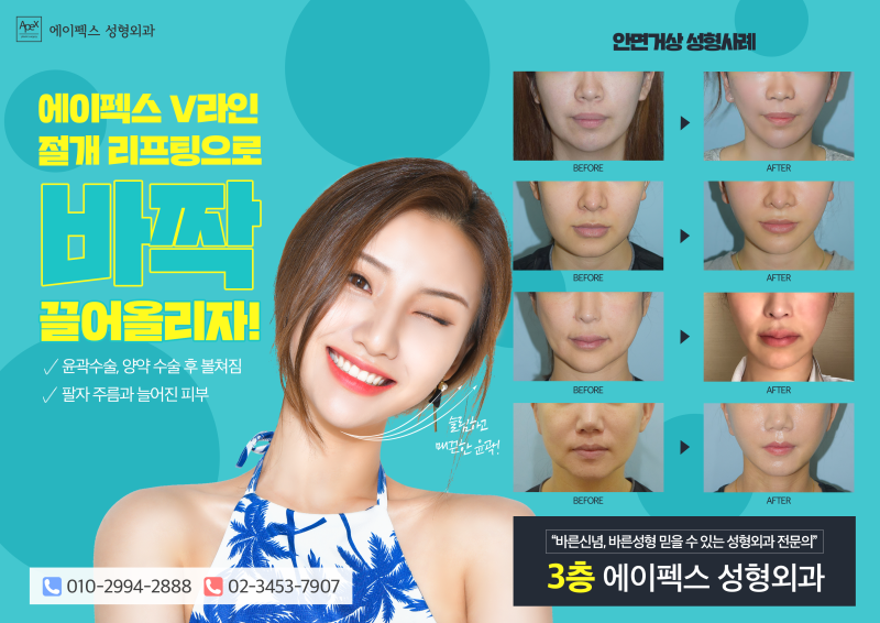 ☆리프팅, 눈성형, 코성형☆ 자연스럽고 확실한 변화 에이펙스성형외과