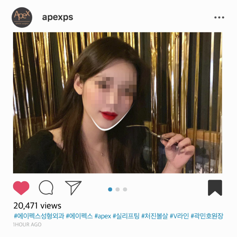 ♡리프팅성형♡ 페이스리프팅, 리프팅 성형 추천 "에이펙스성형외과"