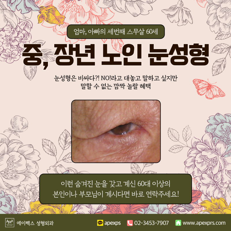 ☆60세 이상 부모님 상안검☆ 부모님 효도 눈성형, 에이펙스에서 놀랄 대특가!