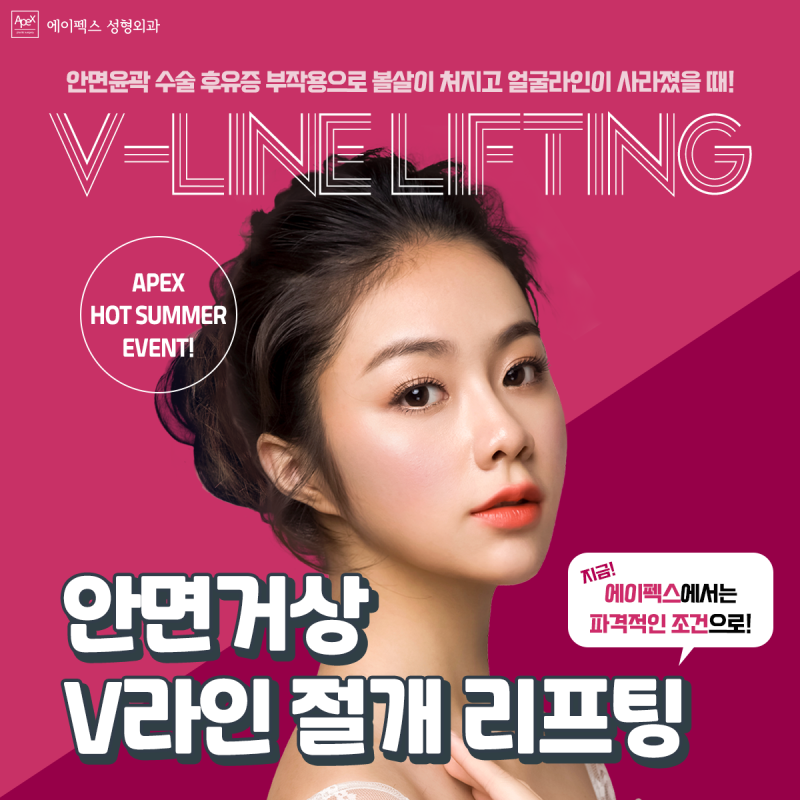 절개리프팅, 실리프팅, 안면거상 ☆에이펙스성형외과☆