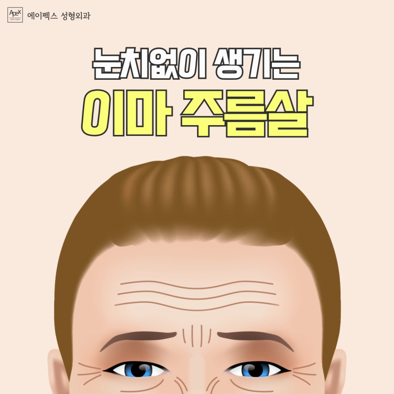 ☆이마거상술☆ 이마주름, 미간주름, 콧잔등주름까지 한번에, 에이펙스성형외과