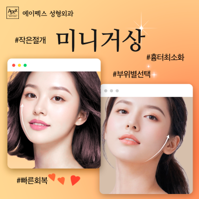 눈&코&거상으로 예뻐지는 뷰티 솔루션, "에이펙스성형외과" 사진 6
