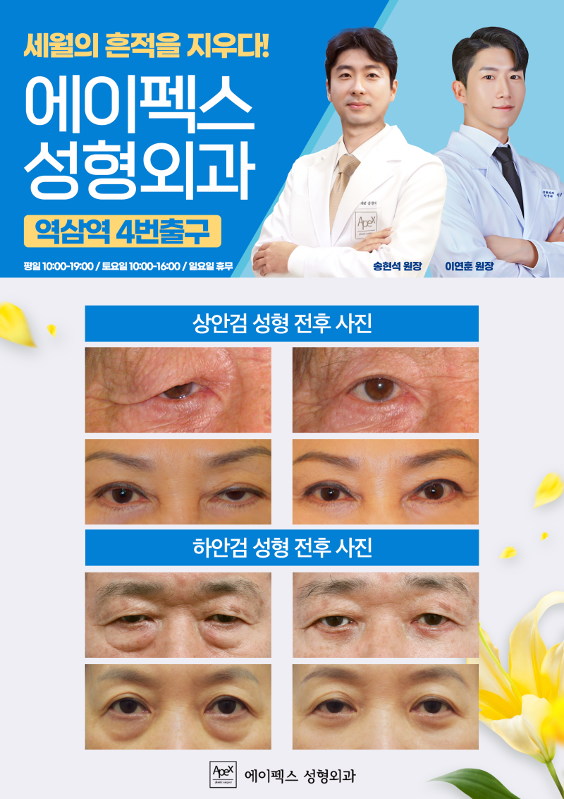 활짝핀 20대부터, 중년까지, "지금을 새롭게 에이펙스성형외과" 사진 8