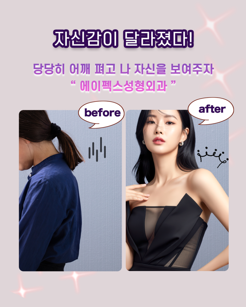 성형고민, 세상 모든 성형정보, 에이펙스성형외과에 다 있다 사진 6