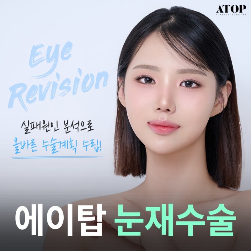 쌍수재수술내돈내산 마지막 눈성형