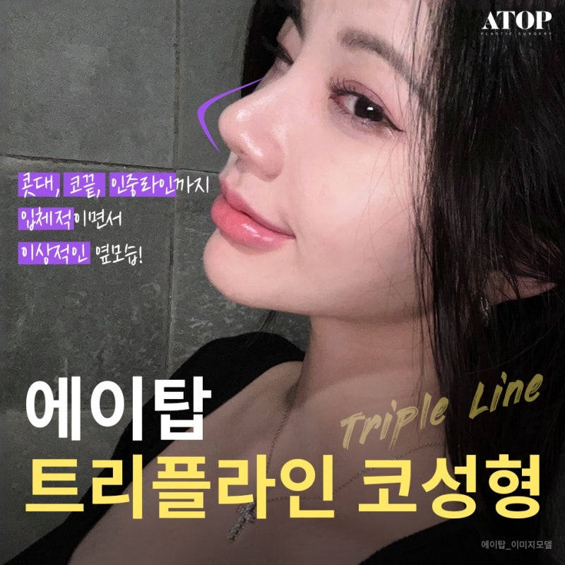 매부리코수술잘하는곳 신중한 결정으로