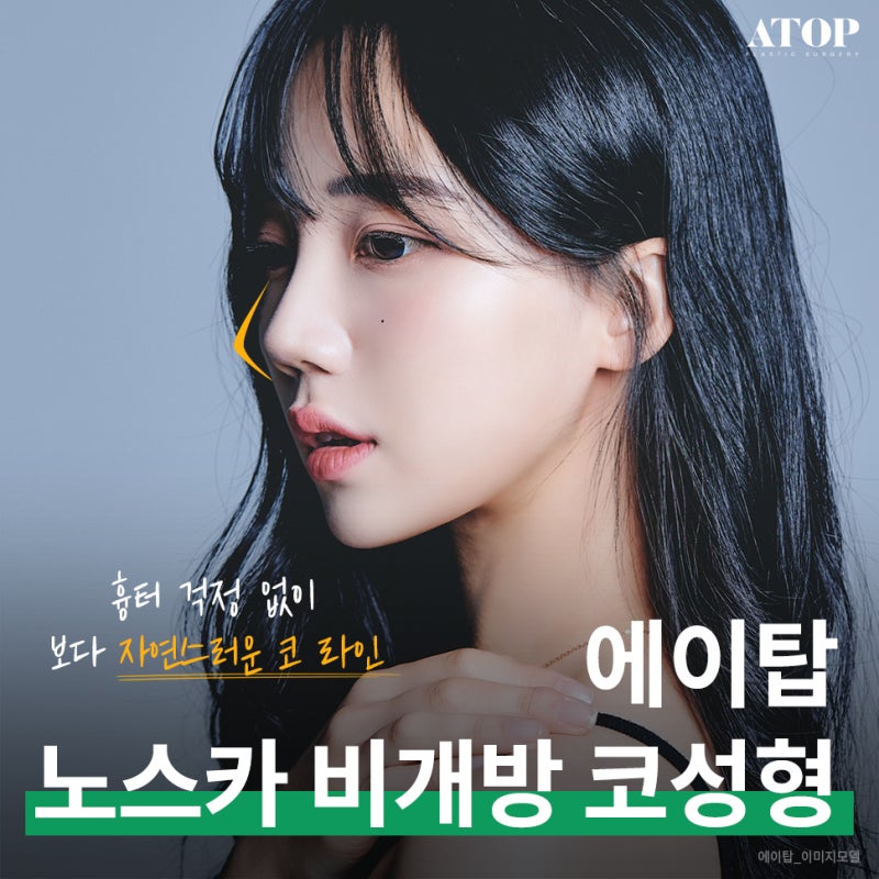 비개방코성형 흉터 걱정을 하지 않도록