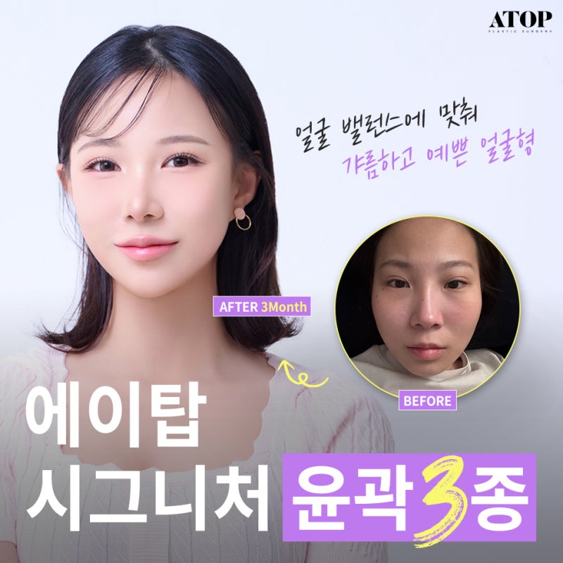 윤곽3종내돈내산 달라진 비포애프터에 만족해