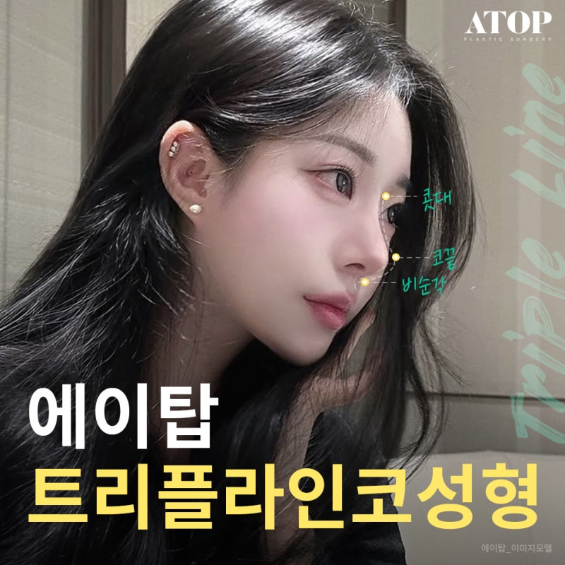 비주성형 디테일한 마무리