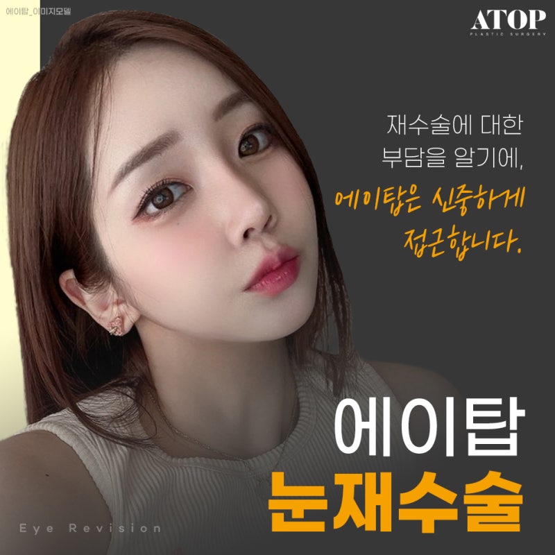 소세지눈재수술후기 소세지눈, 겹주름 해결하려면?