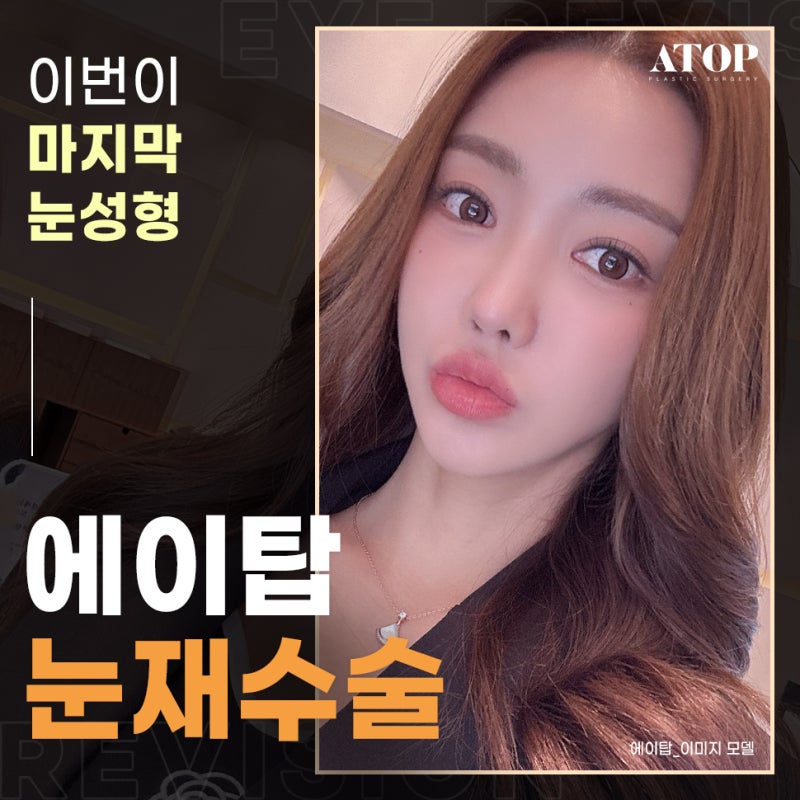 강남쌍꺼풀재수술 소세지눈, 겹주름 해결하려면?