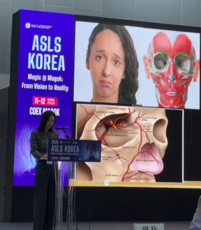 주름지우는 의사 박소현원장 쥬브젠 실리프팅 시술 철학 (삼성비앤에스의원) 사진 12