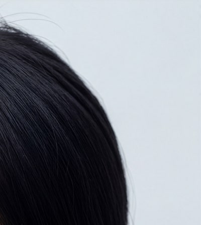 강남쥬브젠 시술 원리와 피부 재생 과정 이해 사진 12