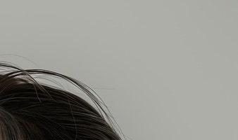 삼성동피부과 울쎄라로 피부 탄력 관리 사진 11