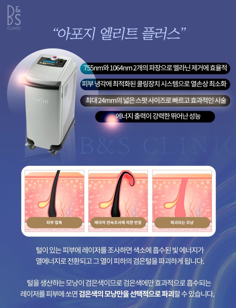삼성동레이저제모 겨드랑이 제모 시술 주기가 중요 사진 7