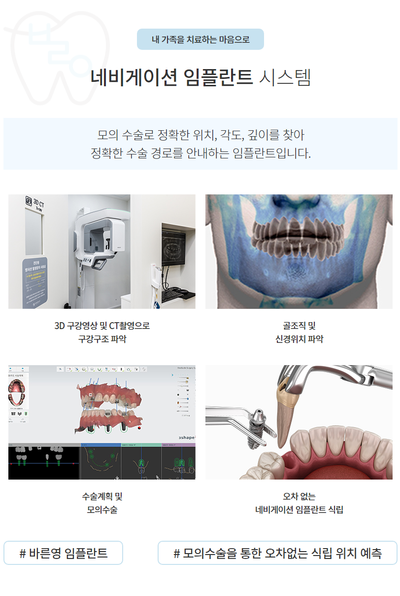 Shindang Station Dental Clinic: Reclaim Your Lost Teeth with Navigation Implants 사진 6