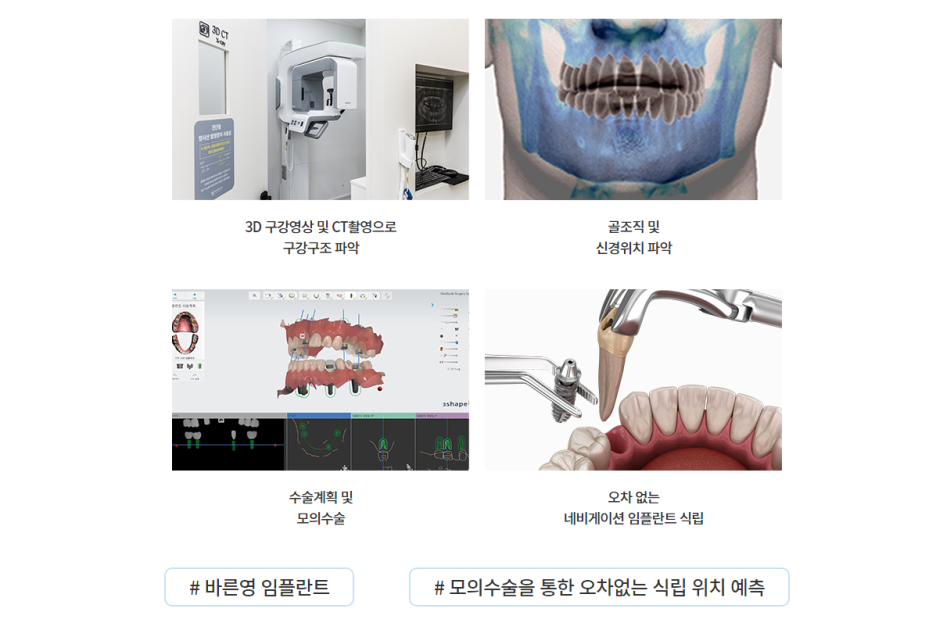 Yaksu Station Dental Clinic: Don't Leave Missing Teeth, Renew with Implants 사진 11
