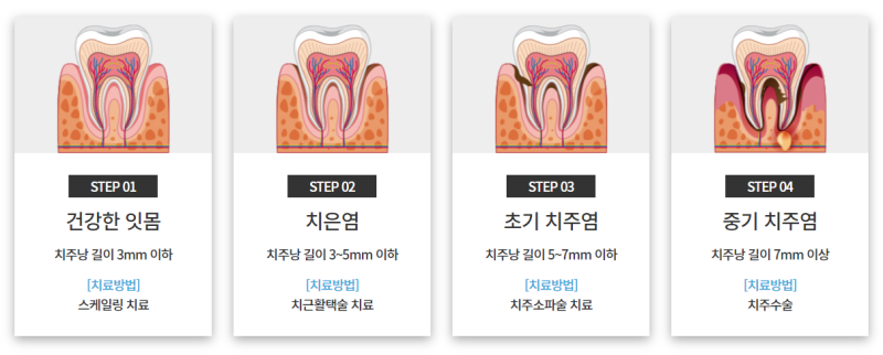 Yaksu Station Dental Clinic: If Your Gums Bleed While Brushing, You Need Gum Inflammation Treatment 사진 10