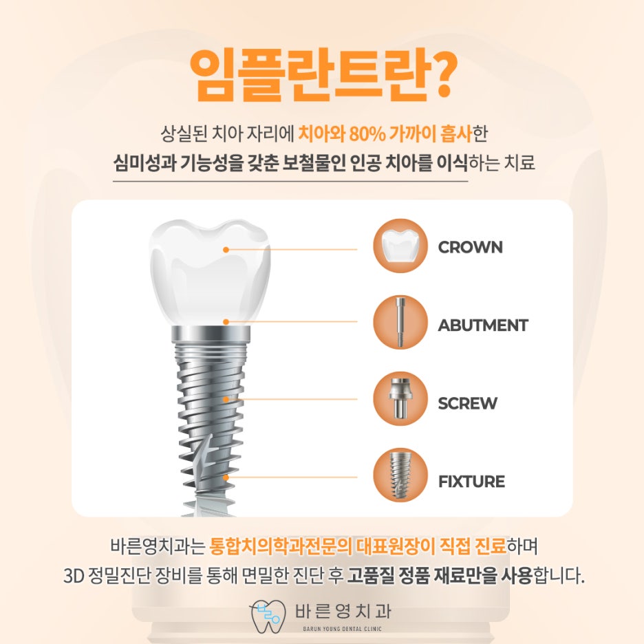 Cheonggu-dong Dental Clinic: Navigation Implants that Locate the Optimal Position for Artificial Teeth 사진 3