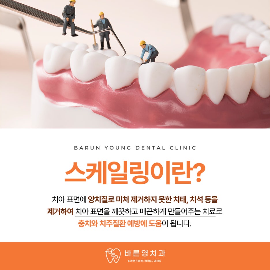 신당역치과, 자꾸만 나는 입냄새 원인은 잇몸염증? 사진 8