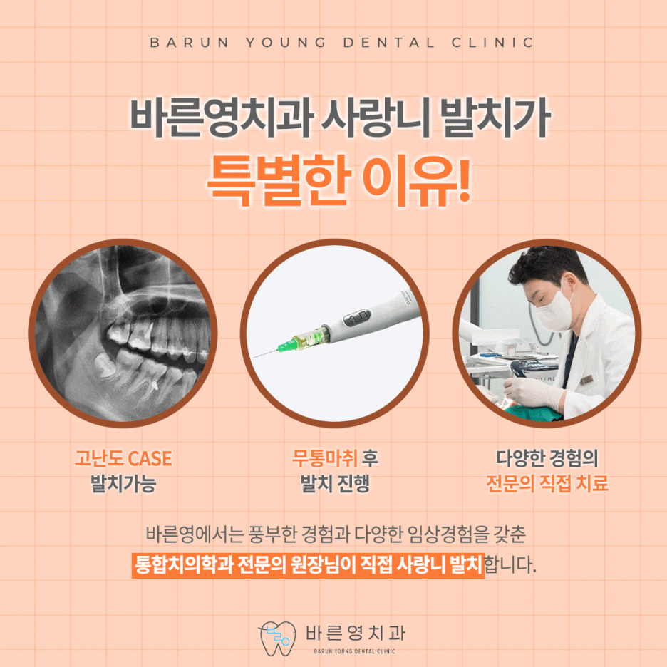 Sindang Station Dental Clinic: Why Wisdom Tooth Extraction is Recommended 사진 8