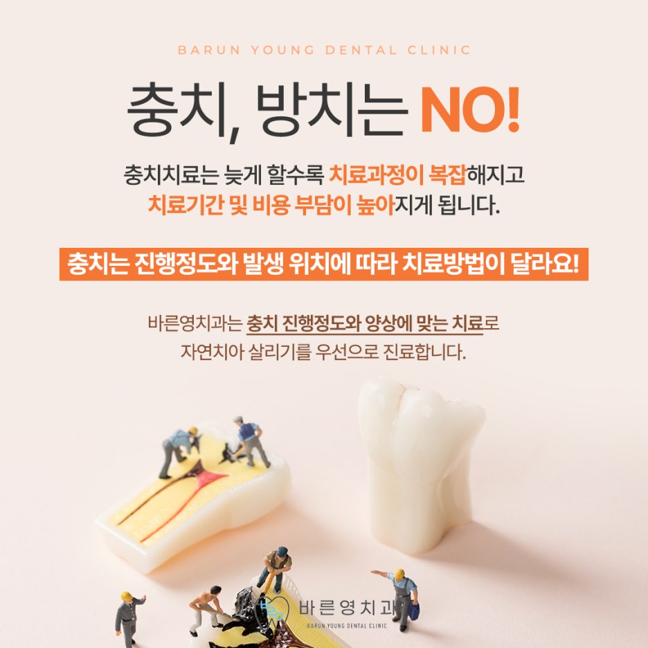 금호역 치과, 자연치아 살리는 마지막 단계 신경치료의 중요성 사진 11