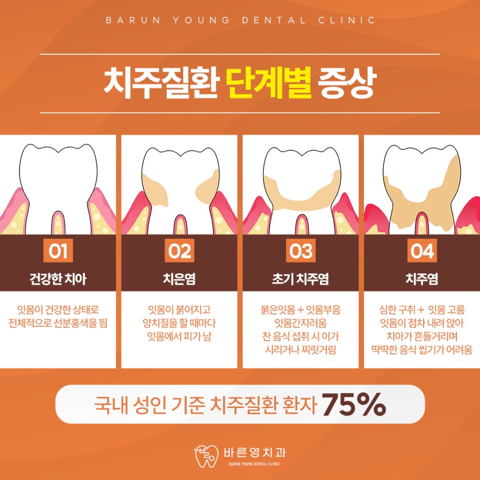약수역치과, 치아 상실할 수도 있는 잇몸질환 예방하려면 사진 5