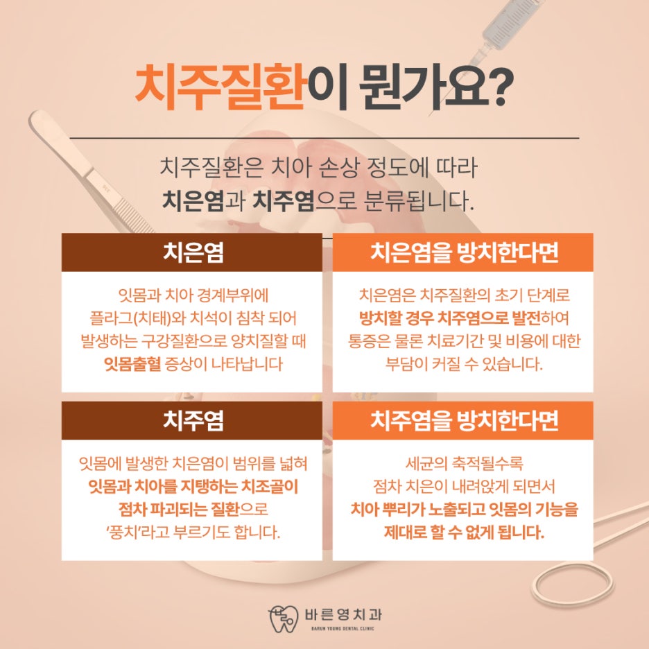 약수역치과, 치아 상실할 수도 있는 잇몸질환 예방하려면 사진 6