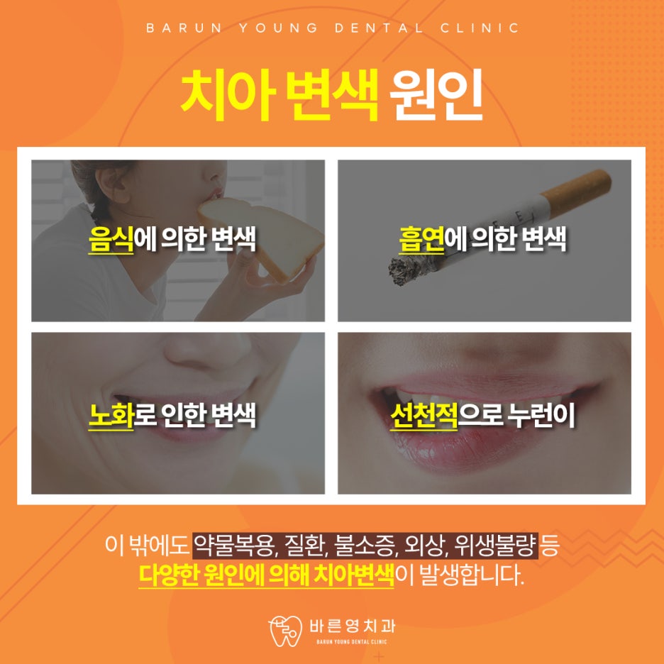 약수역치과, 1:1 맞춤 치아미백으로 자연스럽게