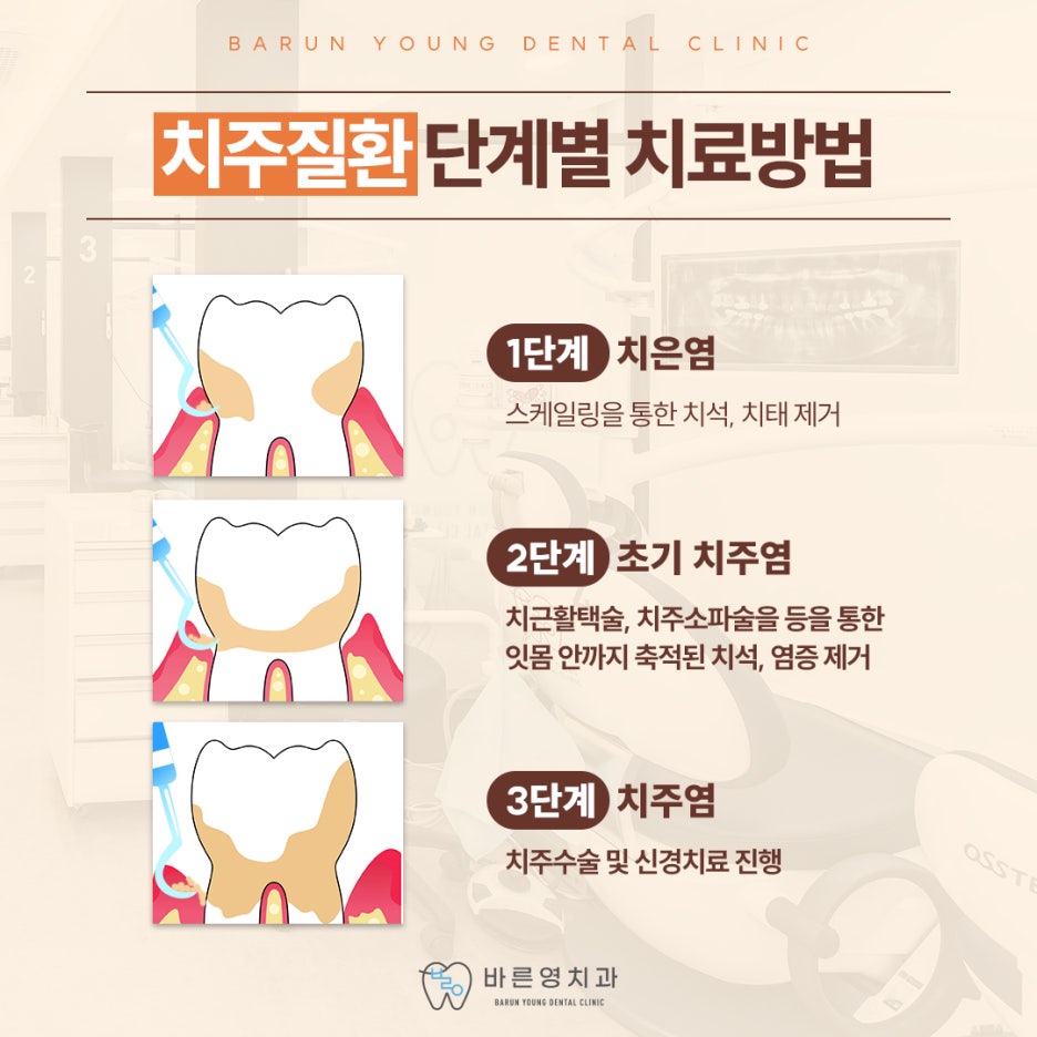 신당역치과, 잇몸에서 피가 나는 이유는 치주질환 때문 사진 7