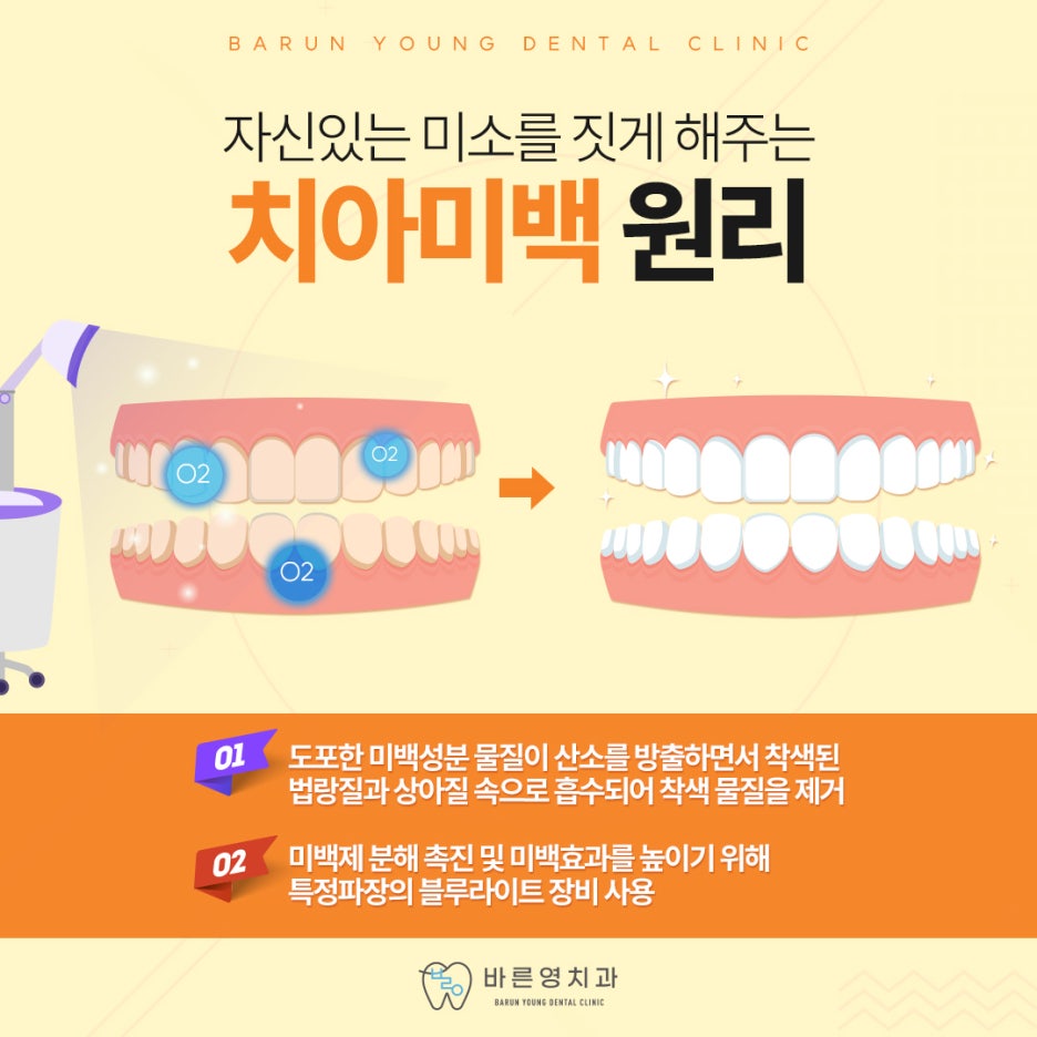 Sindang-dong Dental Clinic: Age and Skin Tone Must Be Considered for Teeth Whitening 사진 6